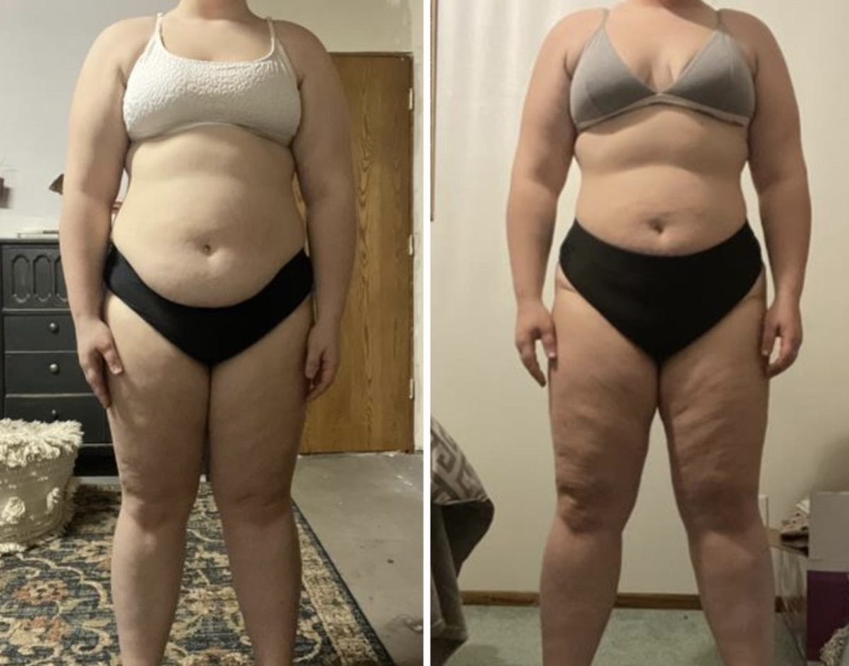Forever Rising client before and after photo showing full body fat loss