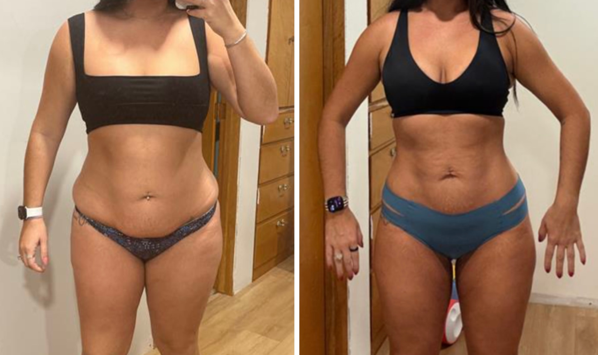 Forever Rising client progress photo showing a tighter waistline