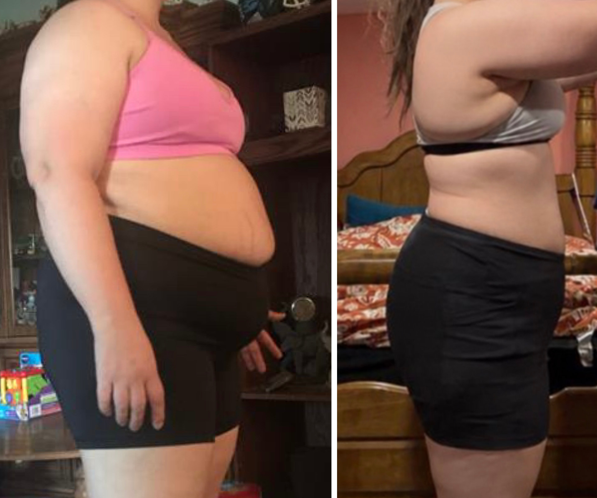 Forever Rising client progress photo showing a slimmer side profile