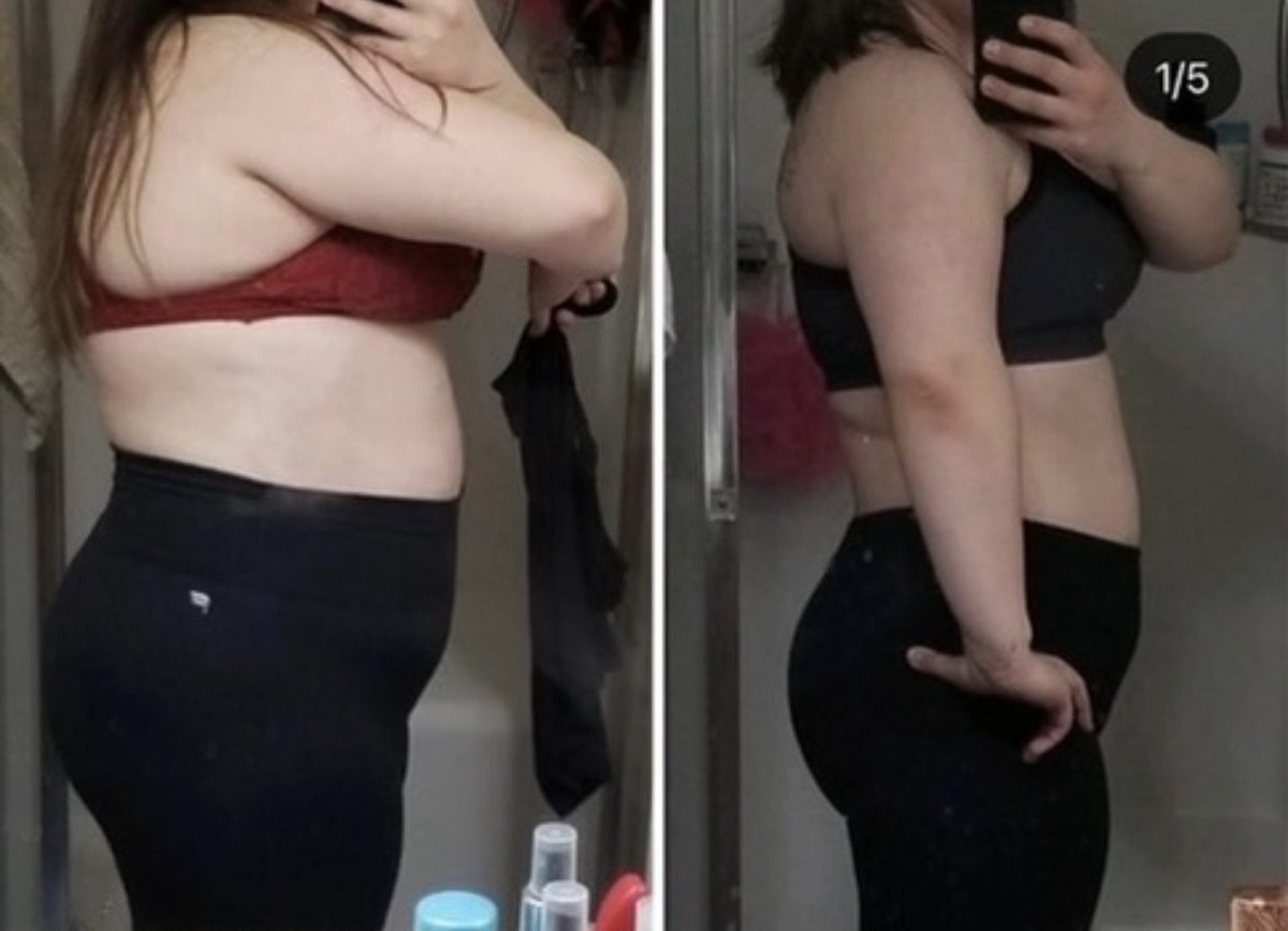 Forever Rising client before and after side profile progress photo