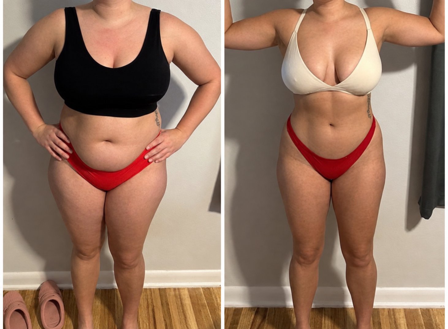 Forever Rising client progress photo showing side by side fat loss